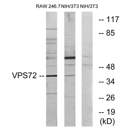 Western Blot - Anti-VPS72 Antibody (C11112) - Antibodies.com