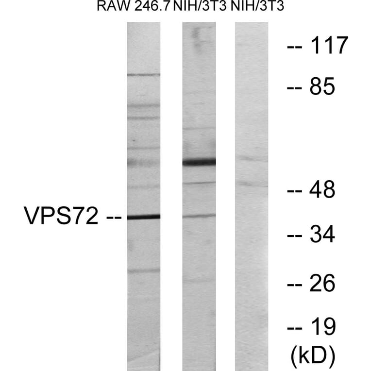 Western Blot - Anti-VPS72 Antibody (C11112) - Antibodies.com