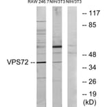 Western Blot - Anti-VPS72 Antibody (C11112) - Antibodies.com