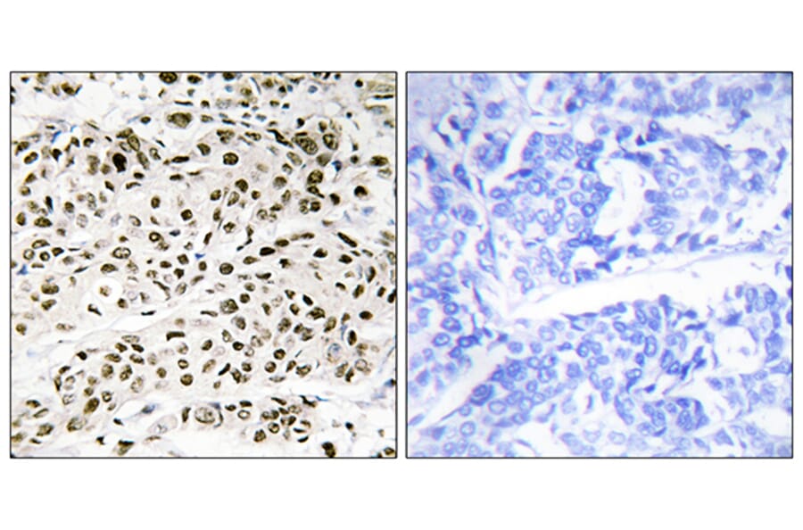 Immunohistochemistry - Anti-VPS72 Antibody (C11112) - Antibodies.com
