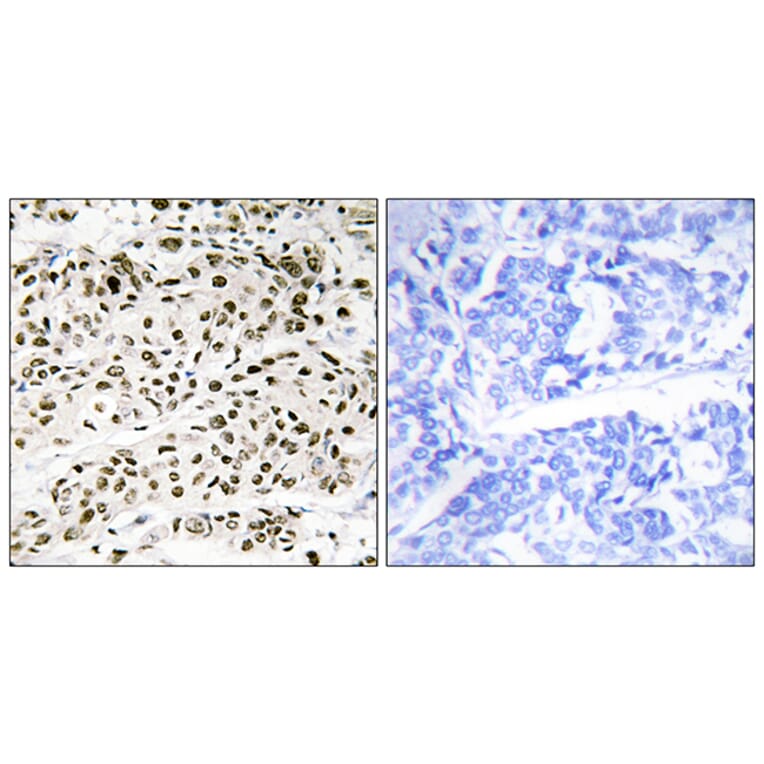 Immunohistochemistry - Anti-VPS72 Antibody (C11112) - Antibodies.com