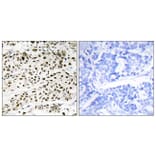 Immunohistochemistry - Anti-VPS72 Antibody (C11112) - Antibodies.com