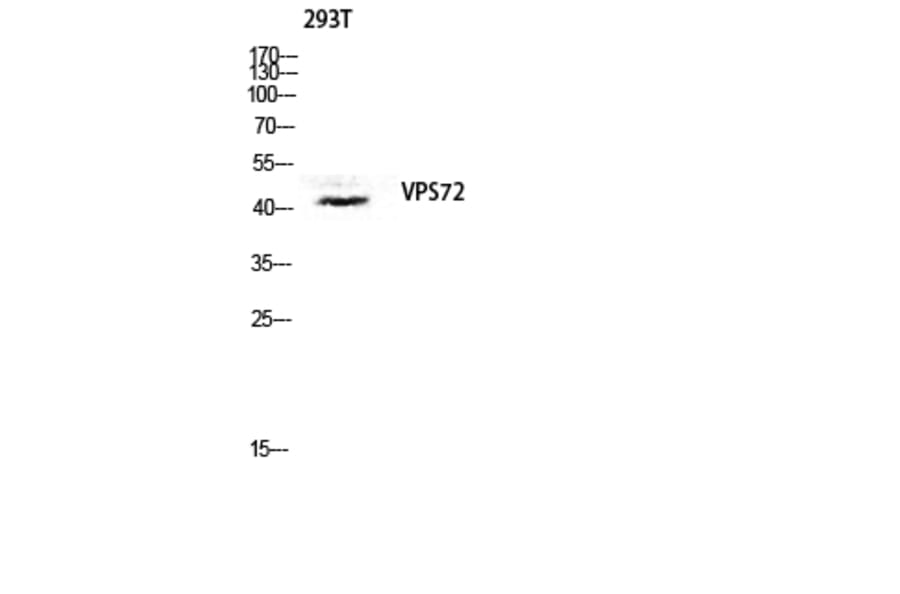 Western Blot - Anti-VPS72 Antibody (C11112) - Antibodies.com