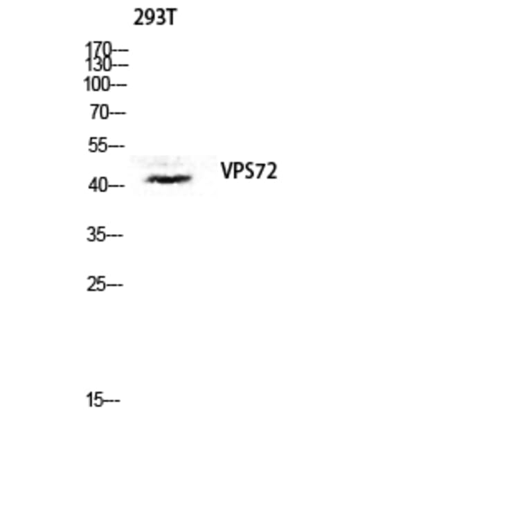 Western Blot - Anti-VPS72 Antibody (C11112) - Antibodies.com