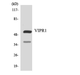 Western Blot - Anti-VIPR1 Antibody (R12-3677) - Antibodies.com