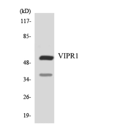 Western Blot - Anti-VIPR1 Antibody (R12-3677) - Antibodies.com