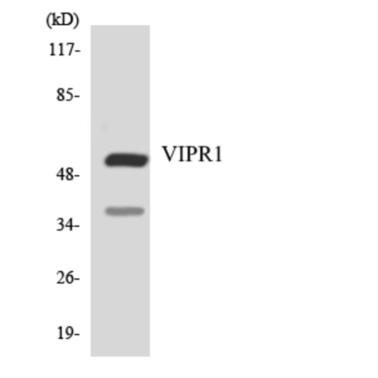 Western Blot - Anti-VIPR1 Antibody (R12-3677) - Antibodies.com