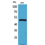 Western Blot - Anti-VEGFC Antibody (C30600) - Antibodies.com