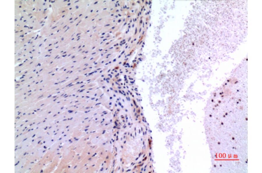 Immunohistochemistry - Anti-VEGFC Antibody (C30600) - Antibodies.com