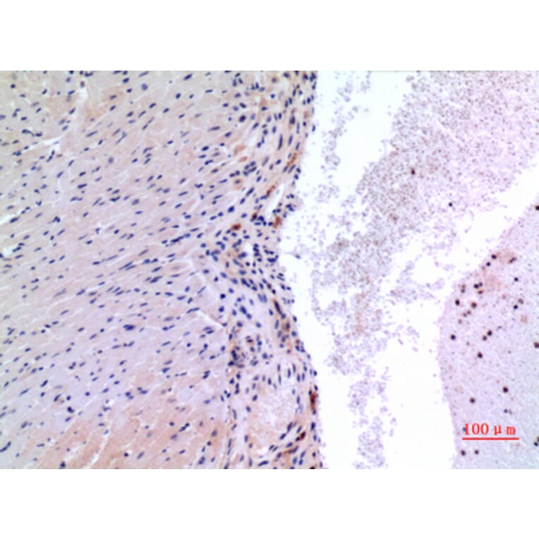 Immunohistochemistry - Anti-VEGFC Antibody (C30600) - Antibodies.com