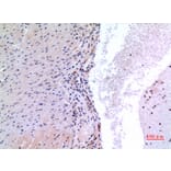Immunohistochemistry - Anti-VEGFC Antibody (C30600) - Antibodies.com
