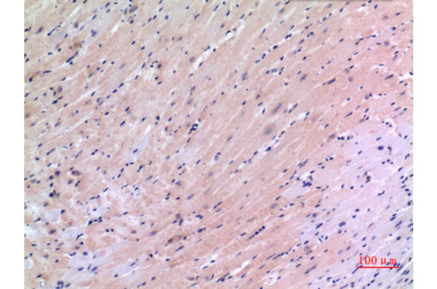 Immunohistochemistry - Anti-VEGFC Antibody (C30600) - Antibodies.com