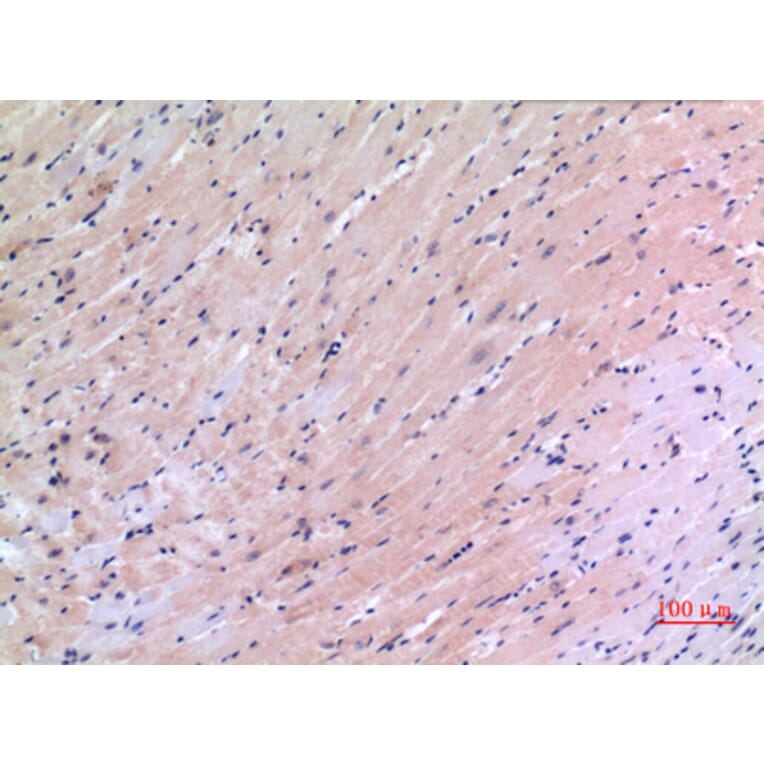Immunohistochemistry - Anti-VEGFC Antibody (C30600) - Antibodies.com