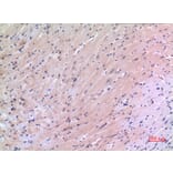 Immunohistochemistry - Anti-VEGFC Antibody (C30600) - Antibodies.com