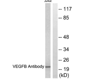 Western Blot - Anti-VEGFB Antibody (C0389) - Antibodies.com