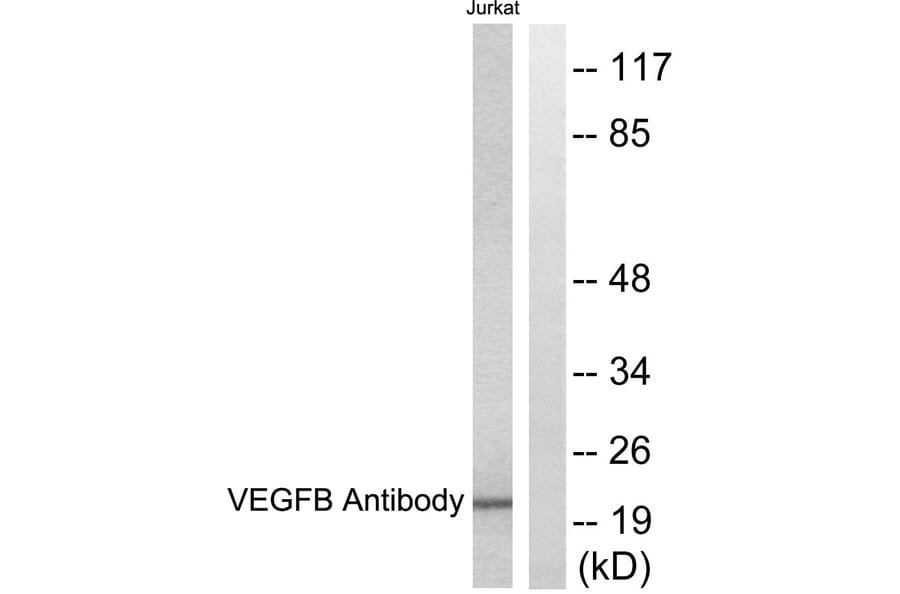 Western Blot - Anti-VEGFB Antibody (C0389) - Antibodies.com
