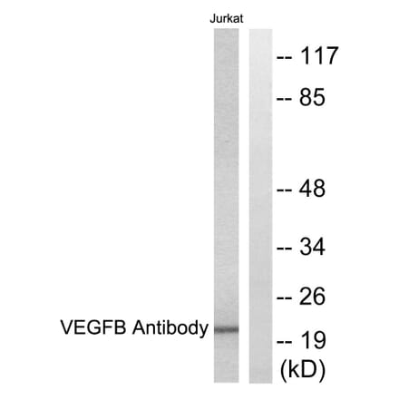 Western Blot - Anti-VEGFB Antibody (C0389) - Antibodies.com