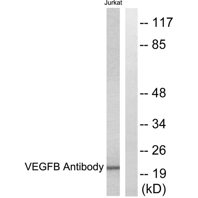 Western Blot - Anti-VEGFB Antibody (C0389) - Antibodies.com