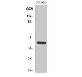 Western Blot - Anti-VASH1 Antibody (C21403) - Antibodies.com