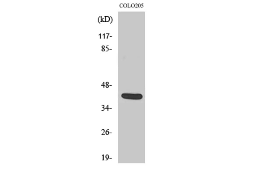 Western Blot - Anti-VASH1 Antibody (C21403) - Antibodies.com