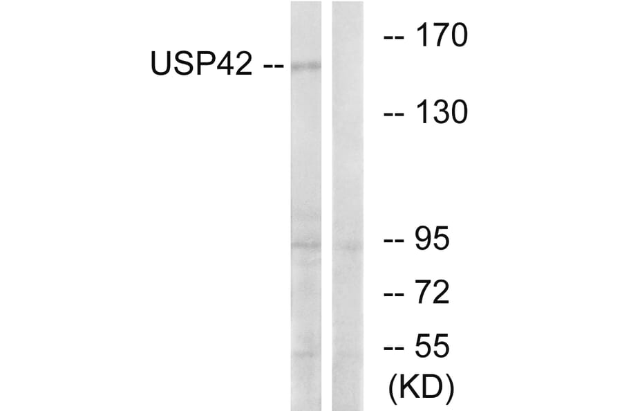 Western Blot - Anti-USP42 Antibody (C19386) - Antibodies.com