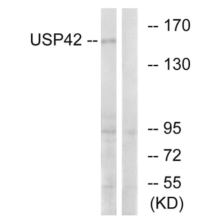 Western Blot - Anti-USP42 Antibody (C19386) - Antibodies.com