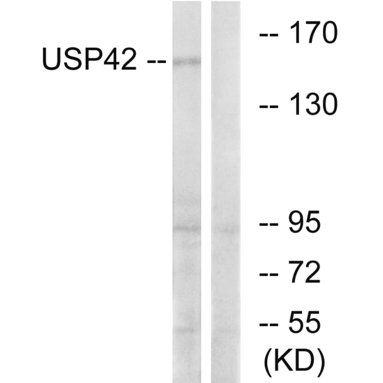 Western Blot - Anti-USP42 Antibody (C19386) - Antibodies.com