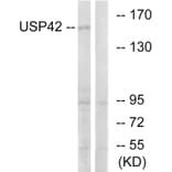 Western Blot - Anti-USP42 Antibody (C19386) - Antibodies.com