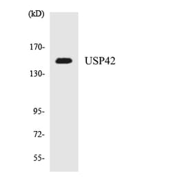 Western Blot - Anti-USP42 Antibody (R12-3671) - Antibodies.com