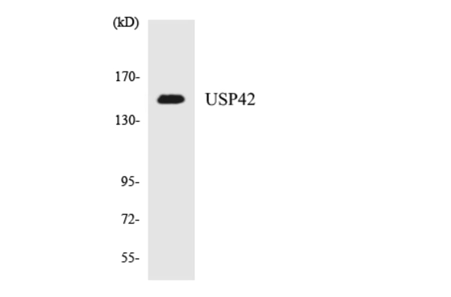 Western Blot - Anti-USP42 Antibody (R12-3671) - Antibodies.com