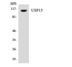 Western Blot - Anti-USP15 Antibody (R12-3669) - Antibodies.com