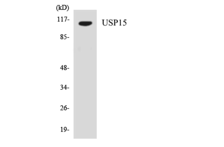 Western Blot - Anti-USP15 Antibody (R12-3669) - Antibodies.com