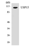 Western Blot - Anti-USP15 Antibody (R12-3669) - Antibodies.com