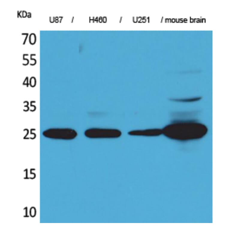 Western Blot - Anti-UCHL1 Antibody (C30007) - Antibodies.com