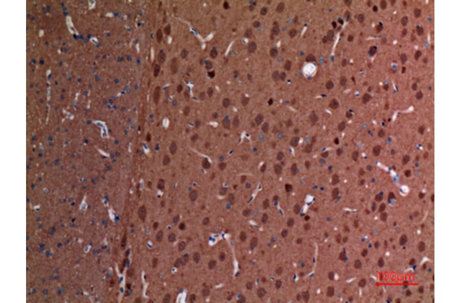 Immunohistochemistry - Anti-UCHL1 Antibody (C30007) - Antibodies.com