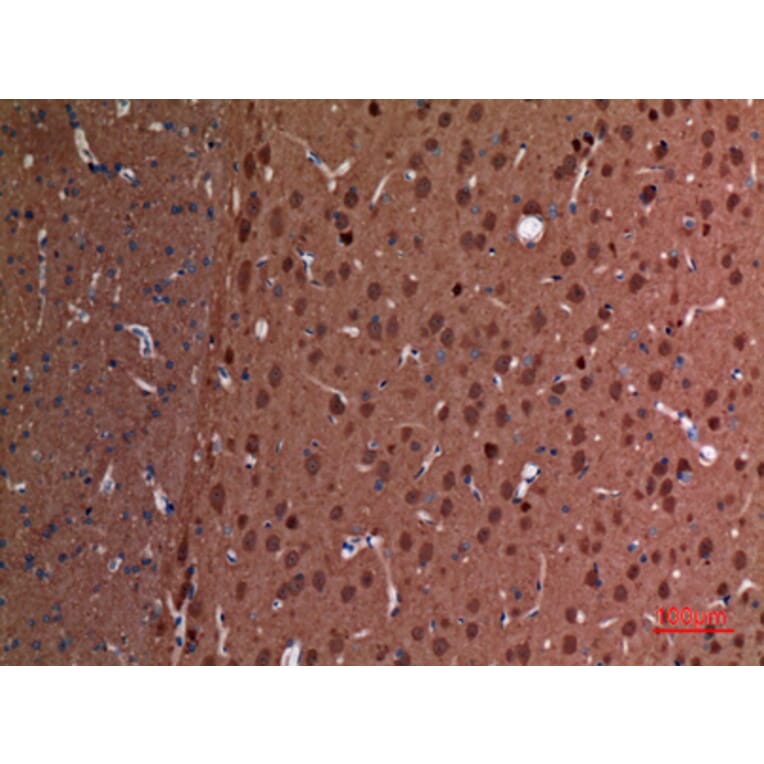 Immunohistochemistry - Anti-UCHL1 Antibody (C30007) - Antibodies.com