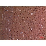 Immunohistochemistry - Anti-UCHL1 Antibody (C30007) - Antibodies.com