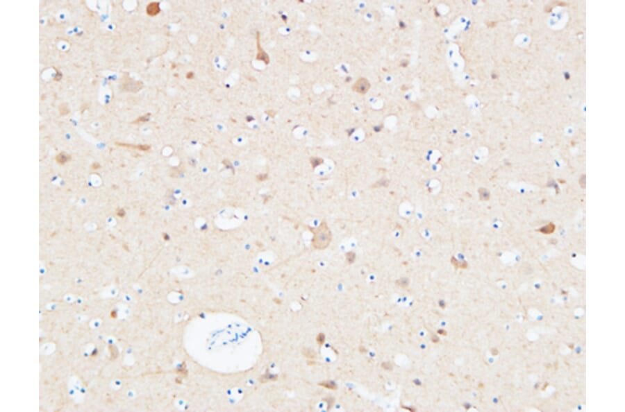 Immunohistochemistry - Anti-UCHL1 Antibody (C30007) - Antibodies.com