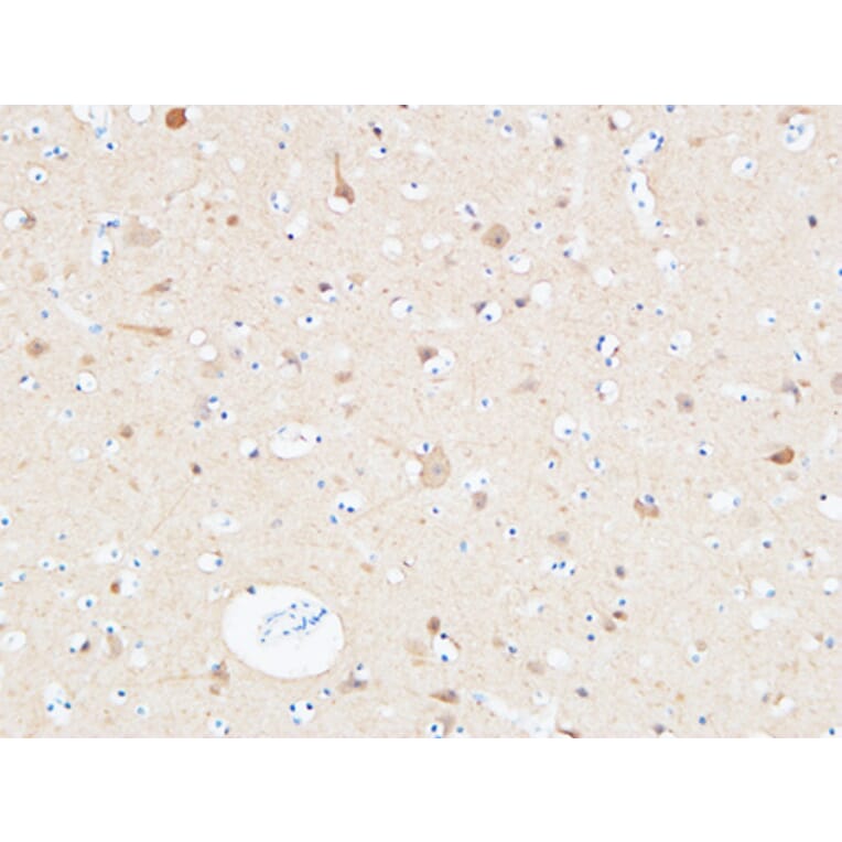 Immunohistochemistry - Anti-UCHL1 Antibody (C30007) - Antibodies.com