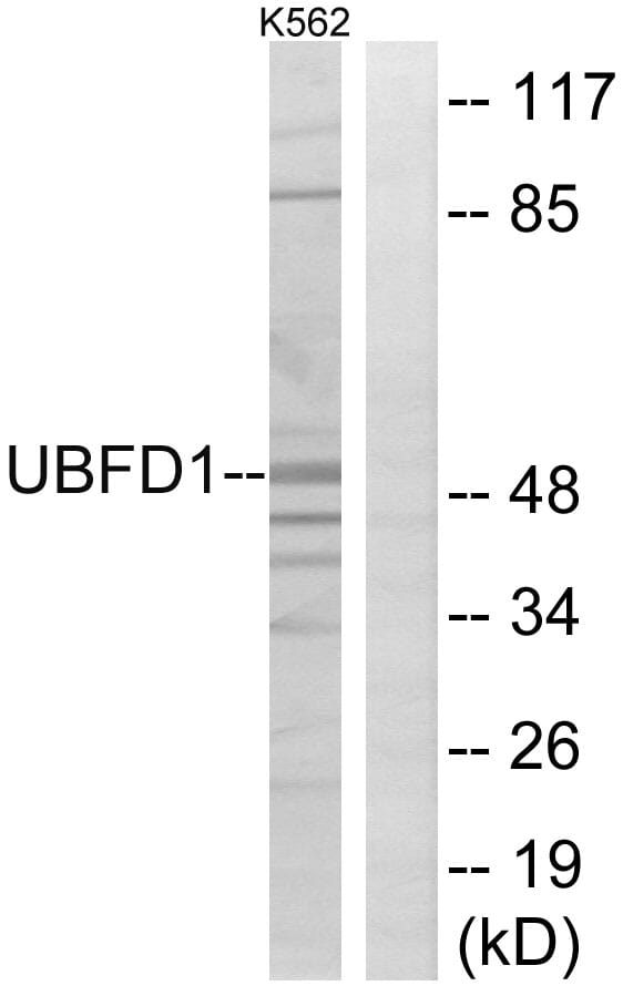 Western blot analysis of lysates from K562 cells using Anti-UBFD1 Antibody. The right hand lane represents a negative control, where the antibody is blocked by the immunising peptide.