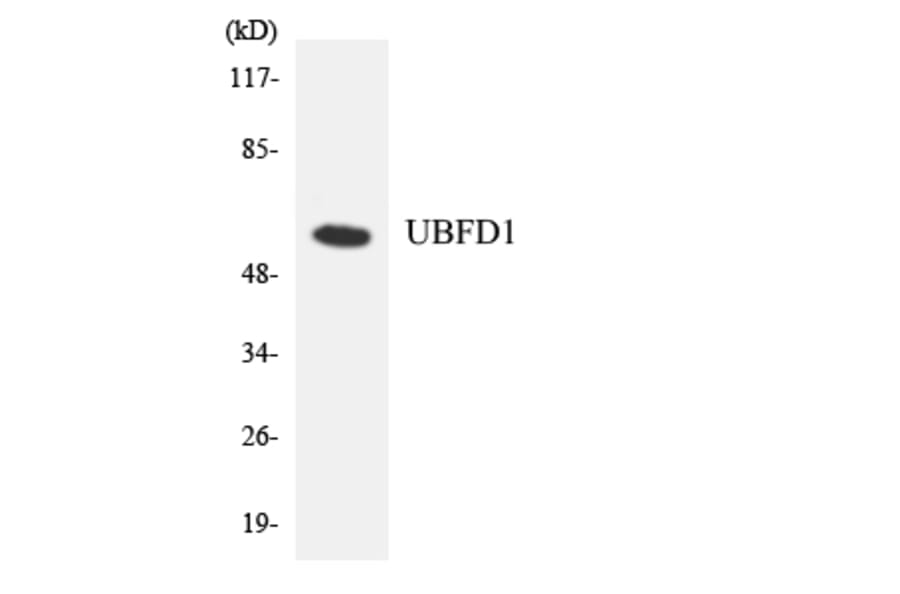 Western Blot - Anti-UBFD1 Antibody (R12-3663) - Antibodies.com