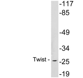 Western Blot - Anti-Twist Antibody (R12-2398) - Antibodies.com
