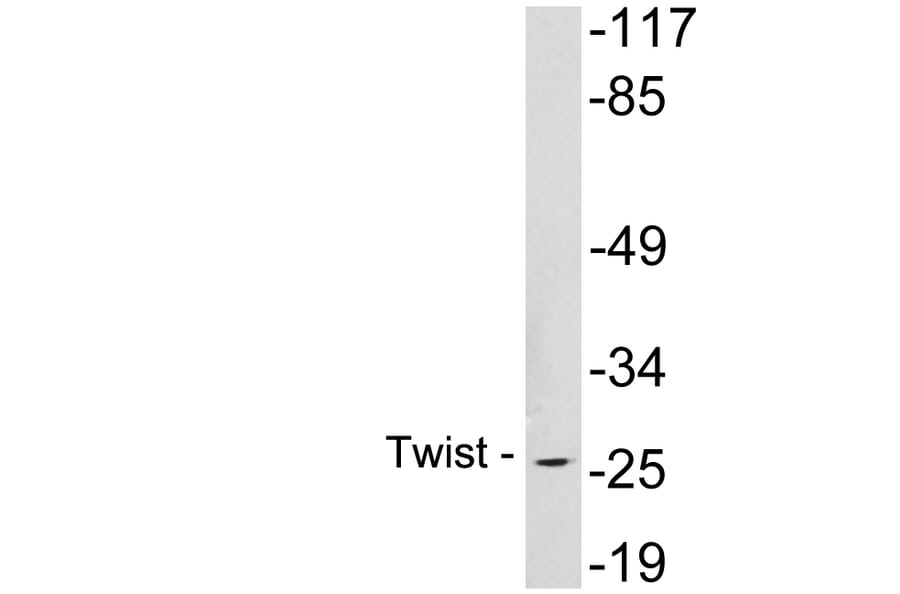 Western Blot - Anti-Twist Antibody (R12-2398) - Antibodies.com