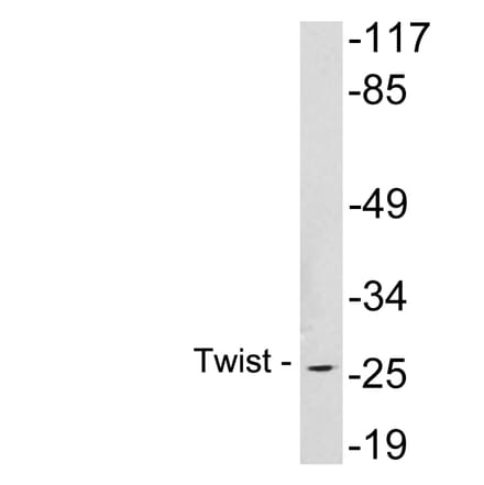 Western Blot - Anti-Twist Antibody (R12-2398) - Antibodies.com