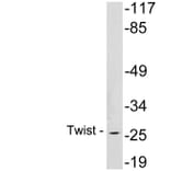 Western Blot - Anti-Twist Antibody (R12-2398) - Antibodies.com