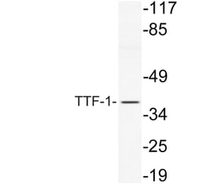 Western Blot - Anti-TTF-1 Antibody (R12-2397) - Antibodies.com