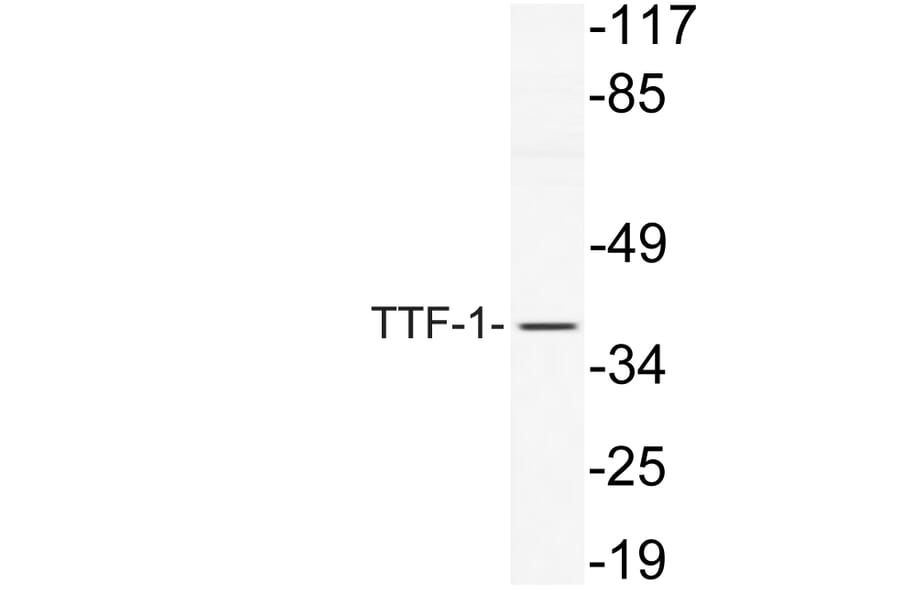 Western Blot - Anti-TTF-1 Antibody (R12-2397) - Antibodies.com