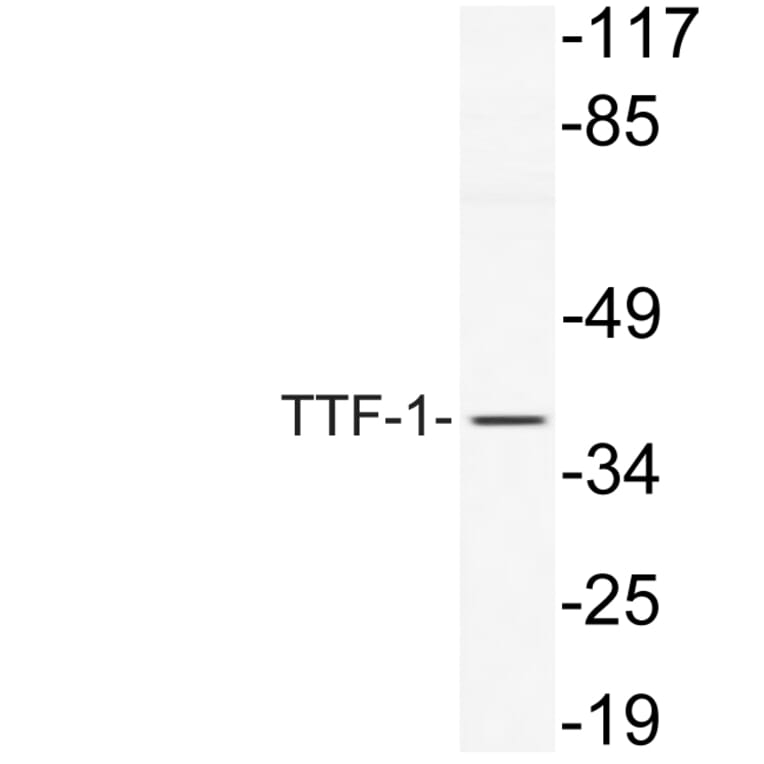 Western Blot - Anti-TTF-1 Antibody (R12-2397) - Antibodies.com