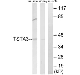 Western Blot - Anti-TSTA3 Antibody (C15900) - Antibodies.com