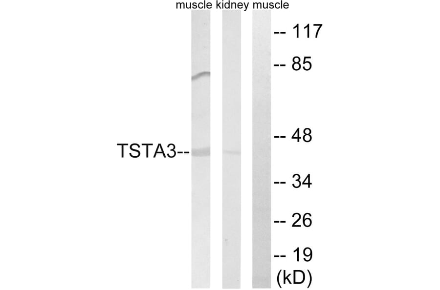 Western Blot - Anti-TSTA3 Antibody (C15900) - Antibodies.com
